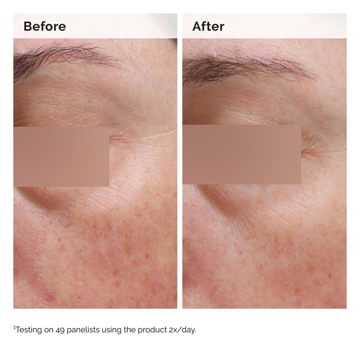 niacinamide-5-face-and-body-emulsion-e4 2024-08-23-ORD-Nia-5pct-Face-Body-B-A-Elasticity-Global-02-1x1.jpg