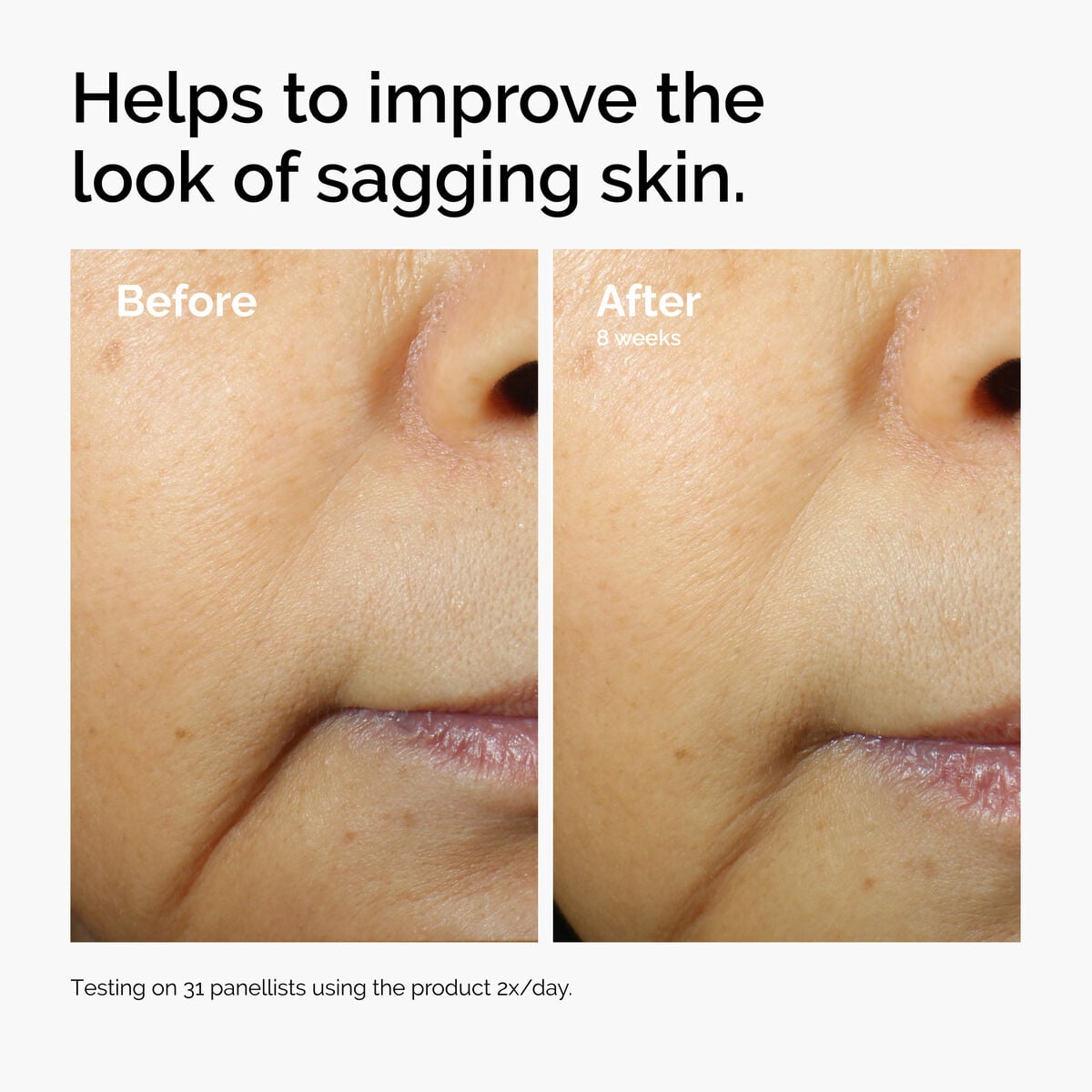 caffeine-3-escin-1-face-serum-e2 ord-caffeine-3pct-escin-1pct-face-serum-before-after-sagging.jpg