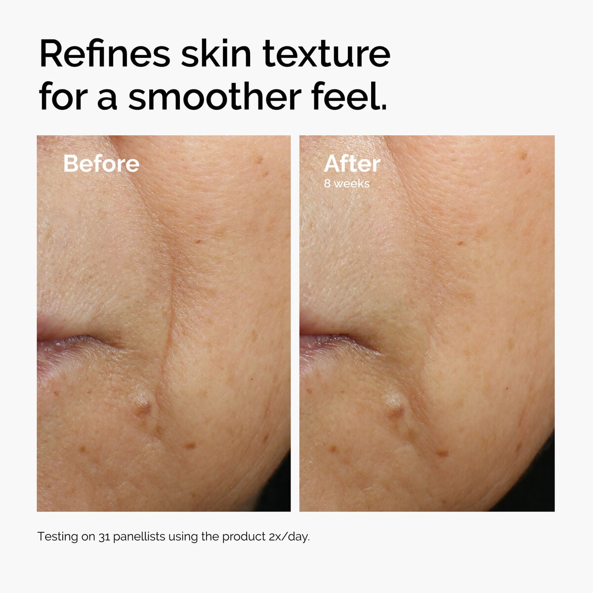 caffeine-3-escin-1-face-serum-e2 ord-caffeine-3pct-escin-1pct-face-serum-before-after-texture.jpg