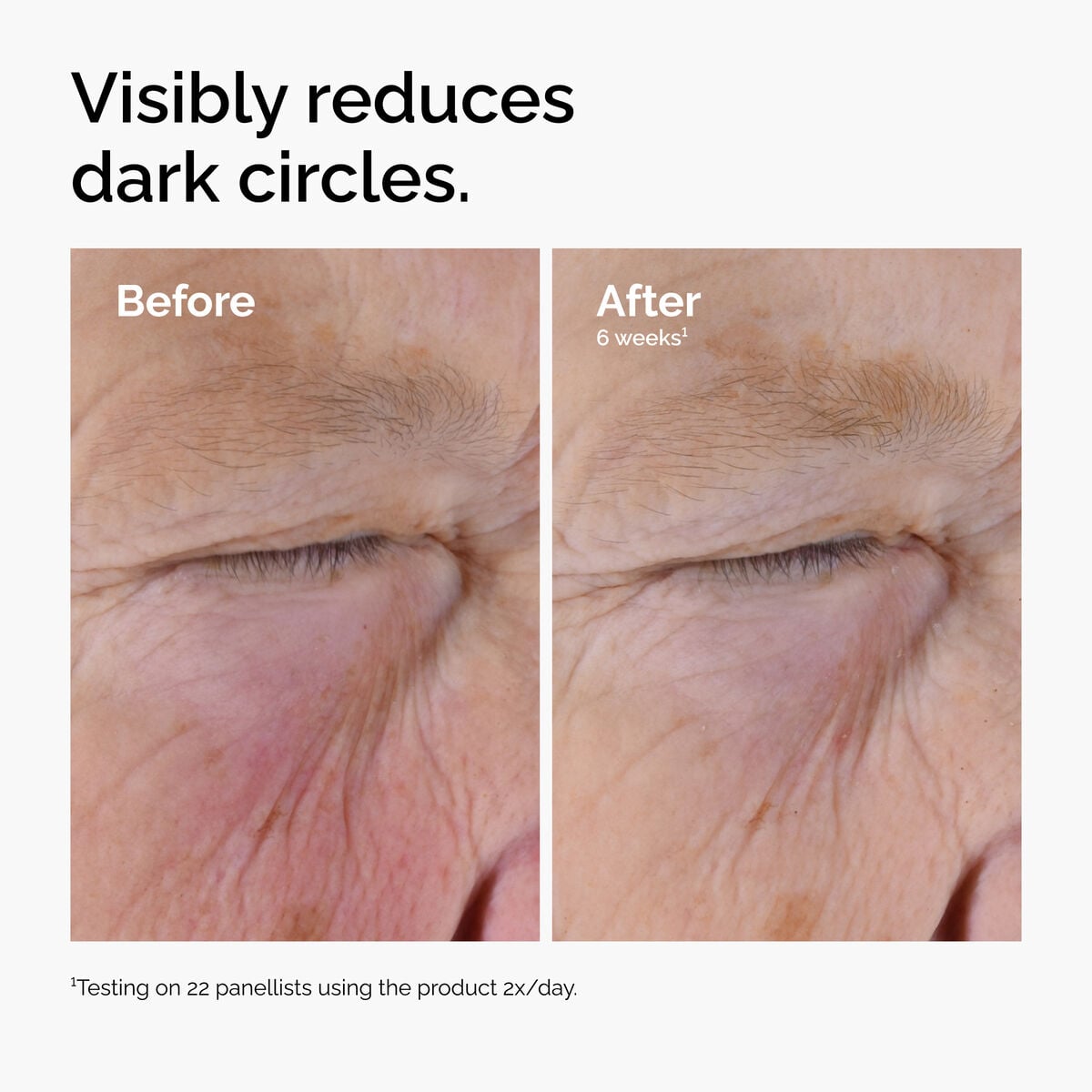 caffeine-solution-5-egcg-eye-serum-d6 ord-caffeine-solution-egcg-dark-circles-before-after.jpg