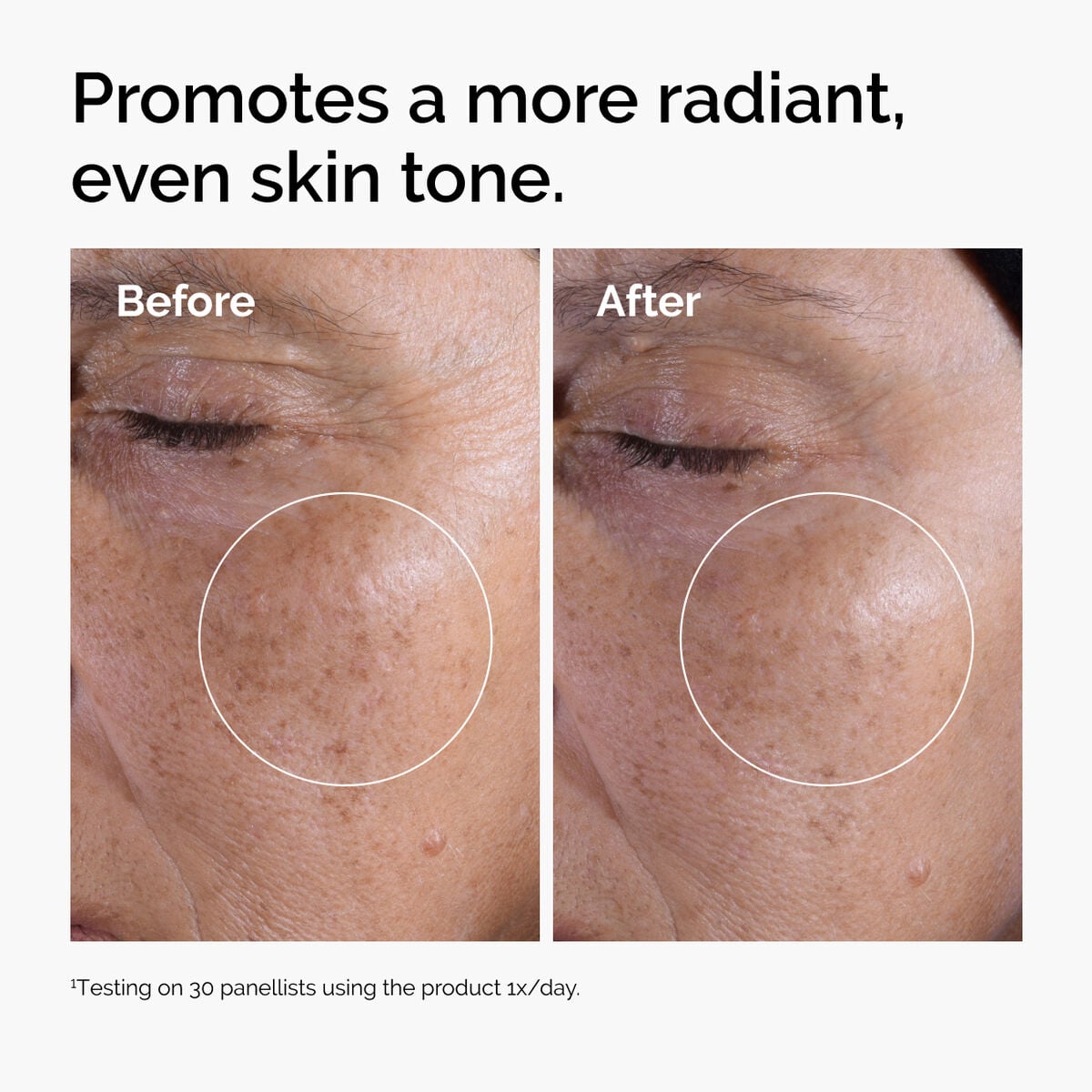 glycolic-acid-7-exfoliating-toner-i7 ord-glycolic-before-after-radiance.jpg