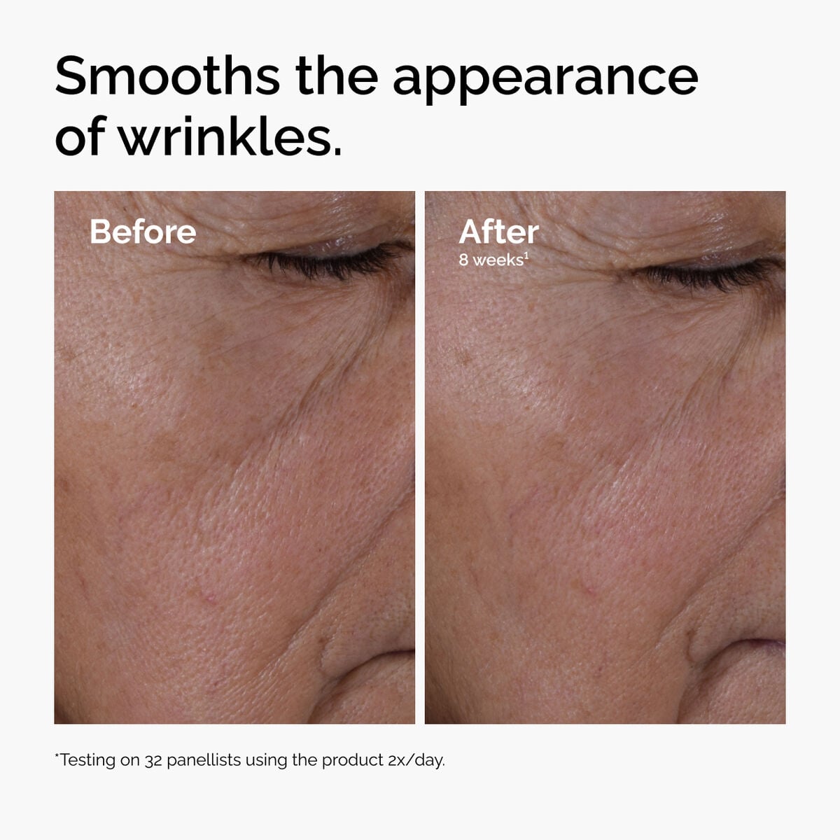 multi-peptide-ha-serum-w5 ord-multi-peptide-ha-serum-wrinkles-before-after.jpg