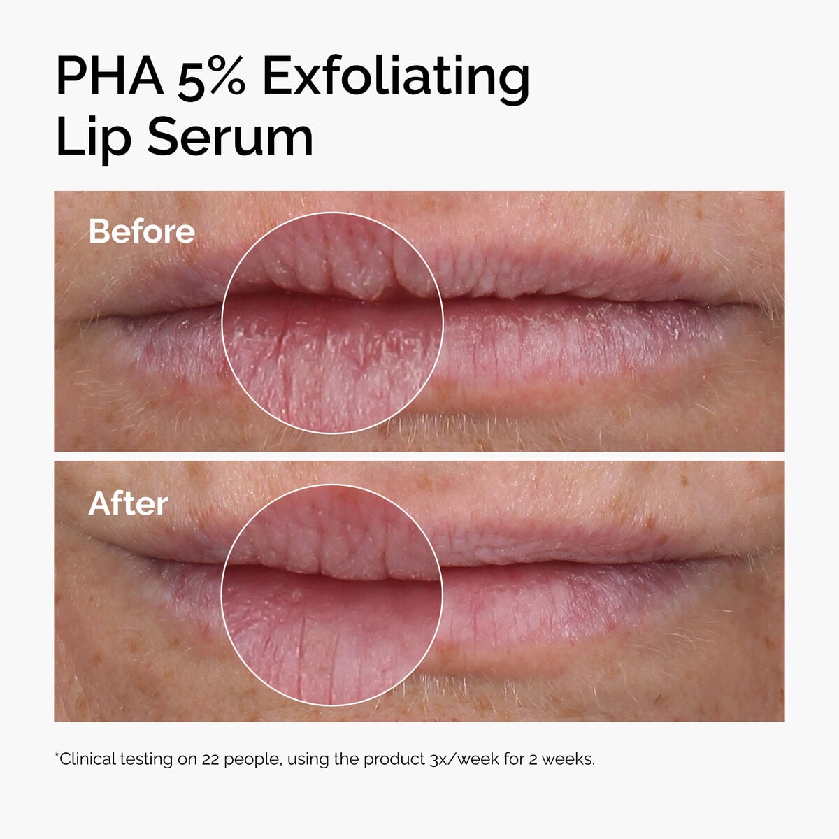 pha-5-exfoliating-lip-serum-s1 ord-pha-5pct-lip-exfoliating-serum-before-after.jpg
