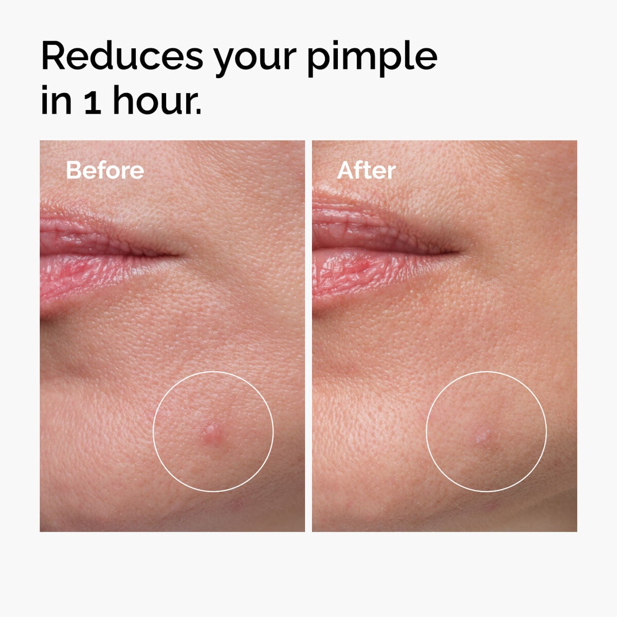 sulfur-10-powder-to-cream-concentrate-o0 ord-sulfur-10pct-powder-to-cream-concentrate-before-after-NA.jpg